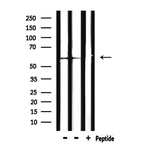 CAT / Catalase Antibody - Western blot analysis of extracts of mouse kidney using Catalase antibody. Lane 1 was treated with the antigen-specific peptide.
