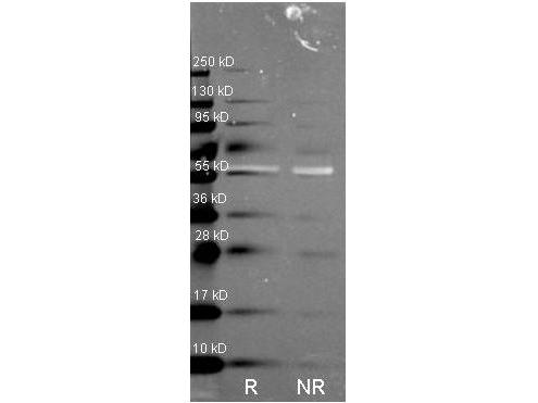 CAT / Catalase Antibody - Western Blot of Rabbit anti-Catalase antibody. Lane R: Reduced samples of purified Catalase. Lane NR: Non-reduced samples of purified Catalase. Load: ~1ug of protein per lane. Primary antibody: Catalase antibody at 1:1000 for overnight at 4°C. Secondary antibody: Dylight488™ rabbit secondary antibody at 1:10,000 for 1.5 hrs at RT.