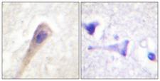CAT / Catalase Antibody - P-peptide - + Immunohistochemistry analysis of paraffin-embedded human brain tissue using Catalase (Phospho-Tyr385) antibody.