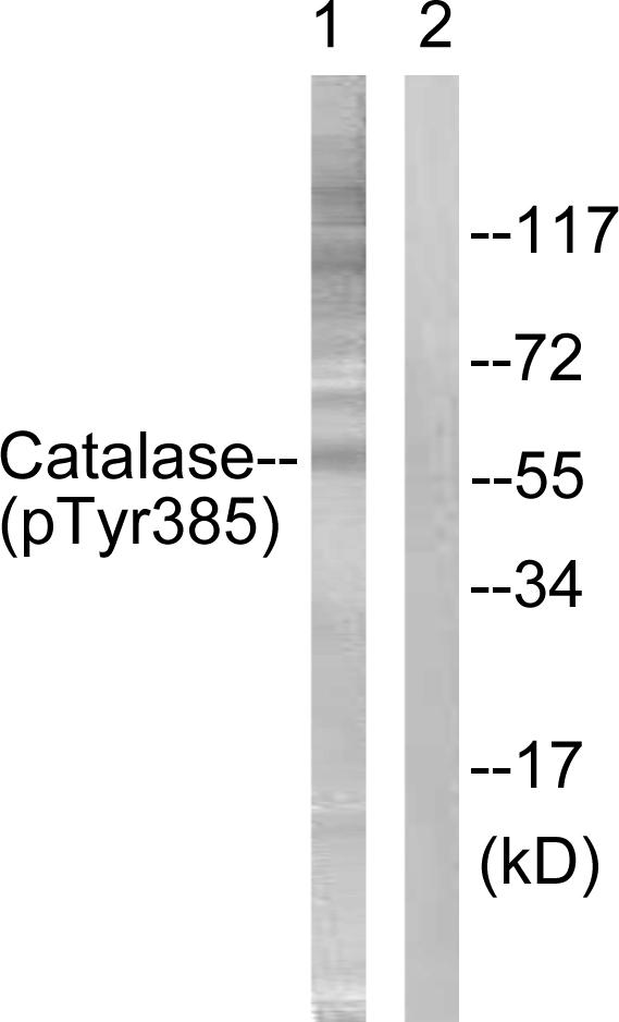 CAT / Catalase Antibody - Western blot analysis of extracts from Jurkat cells, using Catalase (Phospho-Tyr385) antibody.