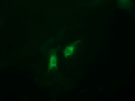 CATIP / C2orf62 Antibody - Anti-C2orf62 mouse monoclonal antibody immunofluorescent staining of COS7 cells transiently transfected by pCMV6-ENTRY C2orf62.