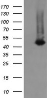 CATIP / C2orf62 Antibody - HEK293T cells were transfected with the pCMV6-ENTRY control (Left lane) or pCMV6-ENTRY C2orf62 (Right lane) cDNA for 48 hrs and lysed. Equivalent amounts of cell lysates (5 ug per lane) were separated by SDS-PAGE and immunoblotted with anti-C2orf62.