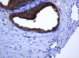 CATIP / C2orf62 Antibody - IHC of paraffin-embedded Human prostate tissue using anti-C2orf62 mouse monoclonal antibody. (Heat-induced epitope retrieval by 10mM citric buffer, pH6.0, 120°C for 3min).