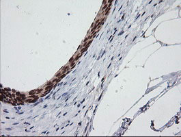 CATIP / C2orf62 Antibody - IHC of paraffin-embedded Human bladder tissue using anti-C2orf62 mouse monoclonal antibody.