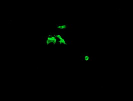 CATIP / C2orf62 Antibody - Anti-C2orf62 mouse monoclonal antibody immunofluorescent staining of COS7 cells transiently transfected by pCMV6-ENTRY C2orf62.