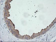CATIP / C2orf62 Antibody - IHC of paraffin-embedded Human breast tissue using anti-C2orf62 mouse monoclonal antibody.