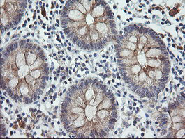 CATIP / C2orf62 Antibody - IHC of paraffin-embedded Human colon tissue using anti-C2orf62 mouse monoclonal antibody.