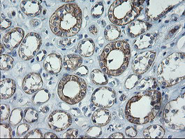 CATIP / C2orf62 Antibody - IHC of paraffin-embedded Human Kidney tissue using anti-C2orf62 mouse monoclonal antibody.