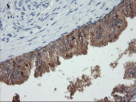 CATIP / C2orf62 Antibody - IHC of paraffin-embedded Human prostate tissue using anti-C2orf62 mouse monoclonal antibody.