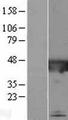 CATIP / C2orf62 Protein - Western validation with an anti-DDK antibody * L: Control HEK293 lysate R: Over-expression lysate