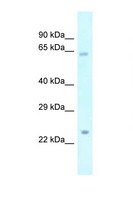 Catip / Gm216 Antibody - Gm216 antibody Western blot of Mouse Pancreas lysate. Antibody concentration 1 ug/ml.  This image was taken for the unconjugated form of this product. Other forms have not been tested.