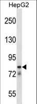 CATSPER1 / CATSPER Antibody - CATSPER1 Antibody western blot of HepG2 cell line lysates (35 ug/lane). The CATSPER1 antibody detected the CATSPER1 protein (arrow).