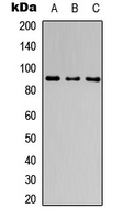 CATSPER1 / CATSPER Antibody - Western blot analysis of CATSPER1 expression in MCF7 (A); NS-1 (B); PC12 (C) whole cell lysates.