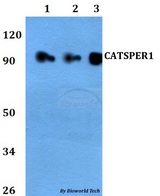 CATSPER1 / CATSPER Antibody - Western blot of CATSPER1 antibody at 1:500 dilution. Lane 1: MCF-7 whole cell lysate. Lane 2: sp2/0 whole cell lysate. Lane 3: PC12 whole cell lysate.