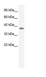 CATSPER2 Antibody - Jurkat Cell Lysate.  This image was taken for the unconjugated form of this product. Other forms have not been tested.