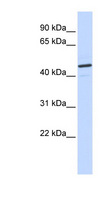 CATSPER2 Antibody - CATSPER2 antibody Western blot of Placenta lysate. This image was taken for the unconjugated form of this product. Other forms have not been tested.