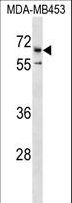 CATSPER2 Antibody - CATSPER2 Antibody western blot of MDA-MB453 cell line lysates (35 ug/lane). The CATSPER2 antibody detected the CATSPER2 protein (arrow).