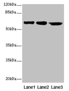 CATSPER2 Antibody - Western blot All lanes: CATSPER2 antibody at 4µg/ml Lane 1: Jurkat whole cell lysate Lane 2: HepG2 whole cell lysate Lane 3: 293T whole cell lysate Secondary Goat polyclonal to rabbit IgG at 1/10000 dilution Predicted band size: 63, 62, 49, 24 kDa Observed band size: 63 kDa