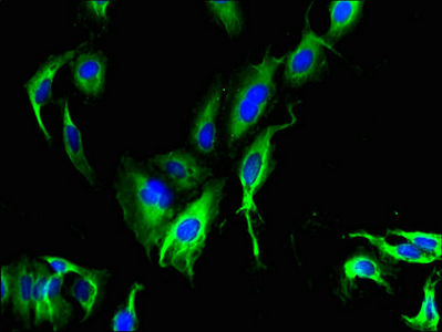 CATSPER4 Antibody - Immunofluorescent analysis of Hela cells using CATSPER4 Antibody at dilution of 1:100 and Alexa Fluor 488-congugated AffiniPure Goat Anti-Rabbit IgG(H+L)