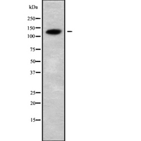 CATSPERB Antibody - Western blot analysis of CATSPERB using COLO205 whole cells lysates