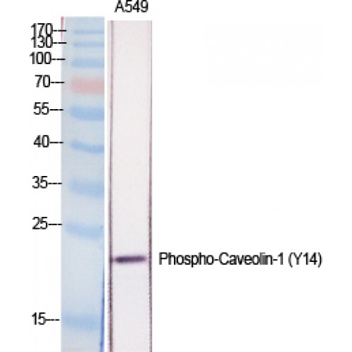 CAV1 / Caveolin 1 Antibody - Western blot of Phospho-Caveolin-1 (Y14) antibody