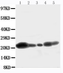 CAV1 / Caveolin 1 Antibody - WB of CAV1 / Caveolin 1 antibody. All lanes: Anti-CAV1 at 0.5ug/ml. Lane 1: U87 Whole Cell Lysate at 40ug. Lane 2: HELA Whole Cell Lysate at 40ug. Lane 3: MCF-7 Whole Cell Lysate at 40ug. Lane 4: A549 Whole Cell Lysate at 40ug. Lane 5: HT1080 Whole Cell Lysate at 40ug. Predicted bind size: 21KD. Observed bind size: 21KD.