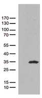 CAV1 / Caveolin 1 Antibody - HEK293T cells were transfected with the pCMV6-ENTRY control. (Left lane) or pCMV6-ENTRY CAV1. (Right lane) cDNA for 48 hrs and lysed. Equivalent amounts of cell lysates. (5 ug per lane) were separated by SDS-PAGE and immunoblotted with anti-CAV1. (1:500)