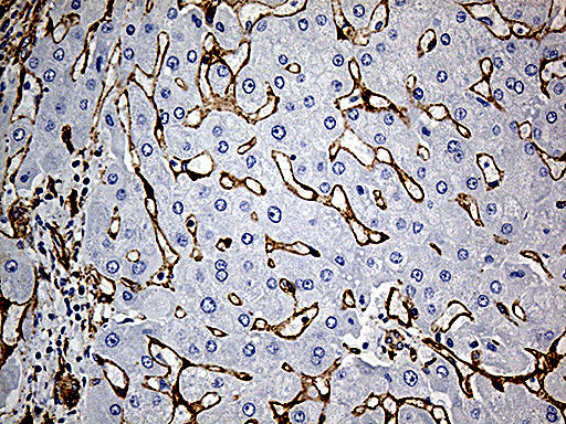 CAV1 / Caveolin 1 Antibody - Immunohistochemical staining of paraffin-embedded Human liver tissue within the normal limits using anti-CAV1 mouse monoclonal antibody. (Heat-induced epitope retrieval by 1mM EDTA in 10mM Tris buffer. (pH8.5) at 120°C for 3 min. (1:500)