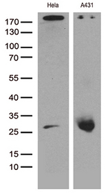 CAV1 / Caveolin 1 Antibody - Western blot analysis of extracts. (35ug) from different 2 cell lines by using anti-CAV1 monoclonal antibody. (1:500)