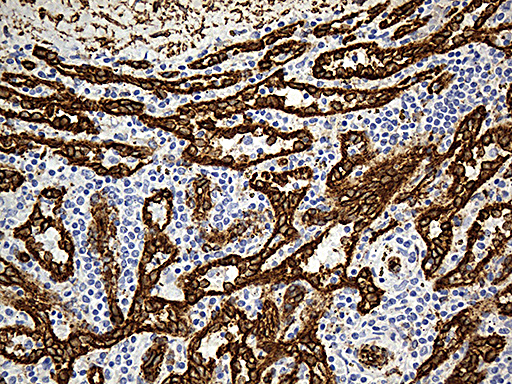 CAV1 / Caveolin 1 Antibody - Immunohistochemical staining of paraffin-embedded Human spleen tissue within the normal limits using anti-CAV1 mouse monoclonal antibody. (Heat-induced epitope retrieval by 1mM EDTA in 10mM Tris buffer. (pH8.5) at 120°C for 3 min. (1:500)