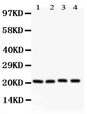 CAV1 / Caveolin 1 Antibody - Caveolin-1 antibody Western blot. All lanes: Anti Caveolin-1 at 0.5 ug/ml. Lane 1: HeLa Whole Cell Lysate at 40 ug. Lane 2: HT1080 Whole Cell Lysate at 40 ug. Lane 3: Human Placenta Tissue Lysate at 50 ug. Lane 4: A431 Whole Cell Lysate at 40 ug. Predicted band size: 21 kD. Observed band size: 21 kD.