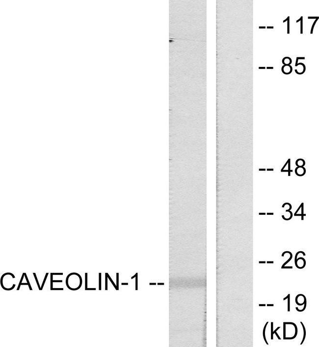 CAV1 / Caveolin 1 Antibody - Western blot analysis of lysates from NIH/3T3 cells, using Caveolin-1 Antibody. The lane on the right is blocked with the synthesized peptide.