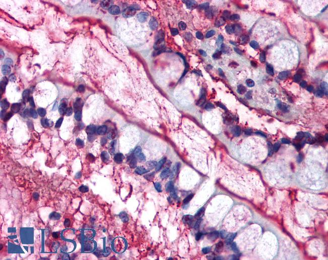CAV1 / Caveolin 1 Antibody - Human Small Intestine (formalin-fixed, paraffin-embedded) stained with CAV1 antibody LS-B150 at 2.5 ug/ml followed by biotinylated anti-mouse IgG secondary antibody, alkaline phosphatase-streptavidin and chromogen.  This image was taken for the unconjugated form of this product. Other forms have not been tested.