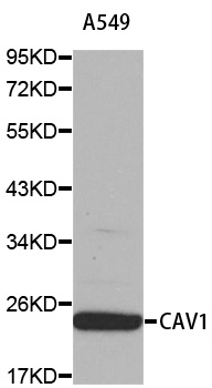 CAV1 / Caveolin 1 Antibody - Western blot analysis of extracts of A-549 cells, using CAV1 antibody. The secondary antibody used was an HRP Goat Anti-Rabbit IgG (H+L) at 1:10000 dilution. Lysates were loaded 25ug per lane and 3% nonfat dry milk in TBST was used for blocking.