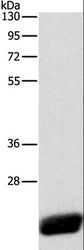 CAV1 / Caveolin 1 Antibody - Western blot analysis of Human leiomyosarcoma tissue, using CAV1 Polyclonal Antibody at dilution of 1:525.