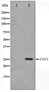 CAV1 / Caveolin 1 Antibody - Western blot of HUVEC cell lysate using Caveolin-1 Antibody