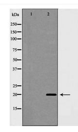 CAV1 / Caveolin 1 Antibody - Western blot of Caveolin 1 expression in HUVEC cell extracts