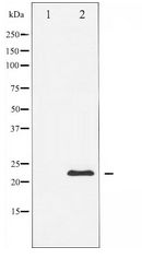 CAV1 / Caveolin 1 Antibody - Western blot of Caveolin-1 expression in NIH-3T3 whole cell lysates,The lane on the left is treated with the antigen-specific peptide.