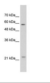 CAV1 / Caveolin 1 Antibody - Jurkat Cell Lysate.  This image was taken for the unconjugated form of this product. Other forms have not been tested.