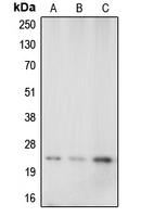 CAV1 / Caveolin 1 Antibody - Western blot analysis of Caveolin 1 expression in A549 (A); mouse brain (B); rat kidney (C) whole cell lysates.