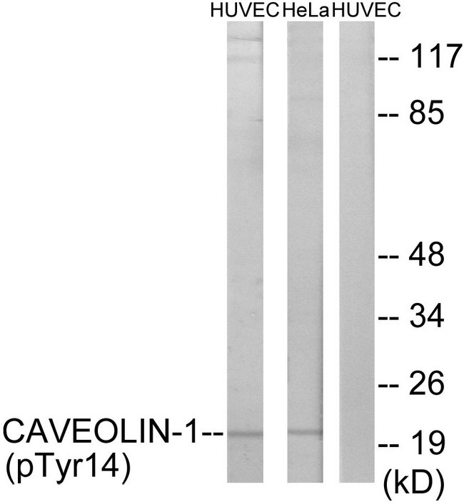 CAV1 / Caveolin 1 Antibody - Western blot analysis of lysates from HUVEC cells treated with PMA 125ng/ml 30' and HeLa cells treated with LPS 100ng/ml 30', using Caveolin-1 (Phospho-Tyr14) Antibody. The lane on the right is blocked with the phospho peptide.