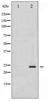 CAV1 / Caveolin 1 Antibody - Western blot of Caveolin-1 phosphorylation expression in H2O2 treated NIH-3T3 whole cell lysates,The lane on the left is treated with the antigen-specific peptide.