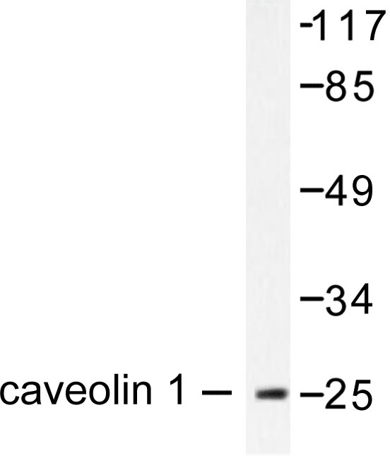 CAV1 / Caveolin 1 Antibody - Western blot of Caveolin-1 (V163) pAb in extracts from HUVEC cells.