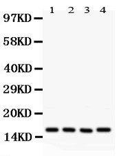 CAV2 / Caveolin 2 Antibody - Caveolin-2 antibody Western blot. All lanes: Anti Caveolin-2 at 0.5 ug/ml. Lane 1: HeLa Whole Cell Lysate at 40 ug. Lane 2: HT1080 Whole Cell Lysate at 40 ug. Lane 3: Human Placenta Tissue Lysate at 50 ug. Lane 4: A431 Whole Cell Lysate at 40 ug. Predicted band size: 17 kD. Observed band size: 17 kD.