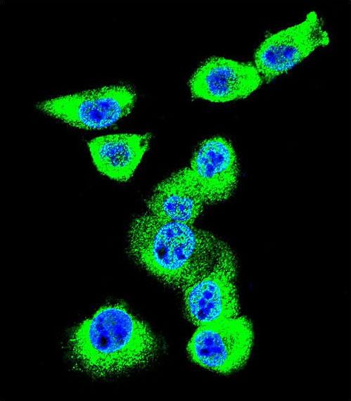CAV2 / Caveolin 2 Antibody - Confocal immunofluorescence of CAV2 Antibody with MDA-MB231 cell followed by Alexa Fluor 488-conjugated goat anti-rabbit lgG (green). DAPI was used to stain the cell nuclear (blue).