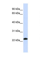 CAV2 / Caveolin 2 Antibody - CAV2 / Caveolin 2 antibody Western blot of Fetal Lung lysate. Antibody concentration 1 ug/ml. This image was taken for the unconjugated form of this product. Other forms have not been tested.