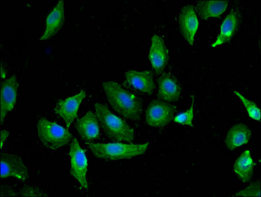 CAV2 / Caveolin 2 Antibody - Immunofluorescent analysis of A549 cells using CAV2 Antibody at a dilution of 1:100 and Alexa Fluor 488-congugated AffiniPure Goat Anti-Rabbit IgG(H+L)