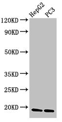 CAV2 / Caveolin 2 Antibody - Western Blot Positive WB detected in: HepG2 whole cell lysate, PC-3 whole cell lysate All lanes: CAV2 antibody at 3µg/ml Secondary Goat polyclonal to rabbit IgG at 1/50000 dilution Predicted band size: 19, 17, 13 kDa Observed band size: 19 kDa