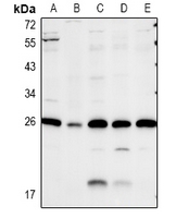 CAV2 / Caveolin 2 Antibody - Western blot analysis of Caveolin 2 expression in CT26 (A), rat kidney (B), A549 (C), COS7 (D), Hela (E) whole cell lysates.