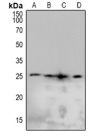 CAV2 / Caveolin 2 Antibody - Western blot analysis of Caveolin 2 (pY19) expression in Hela (A), Jurkat (B), NIH3T3 (C), H9C2 (D) whole cell lysates.